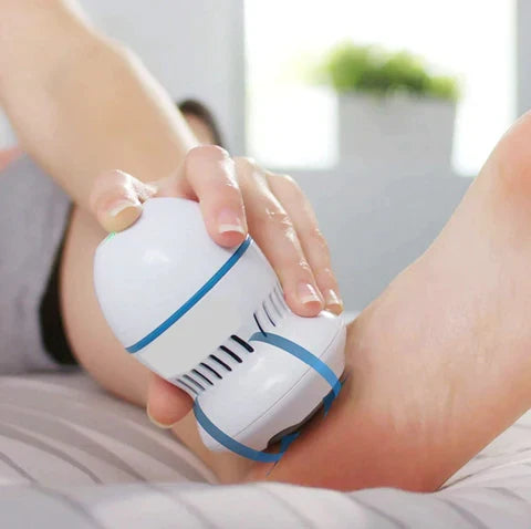 Vacuum Callus Remover – Smooth, Soft Feet in Minutes